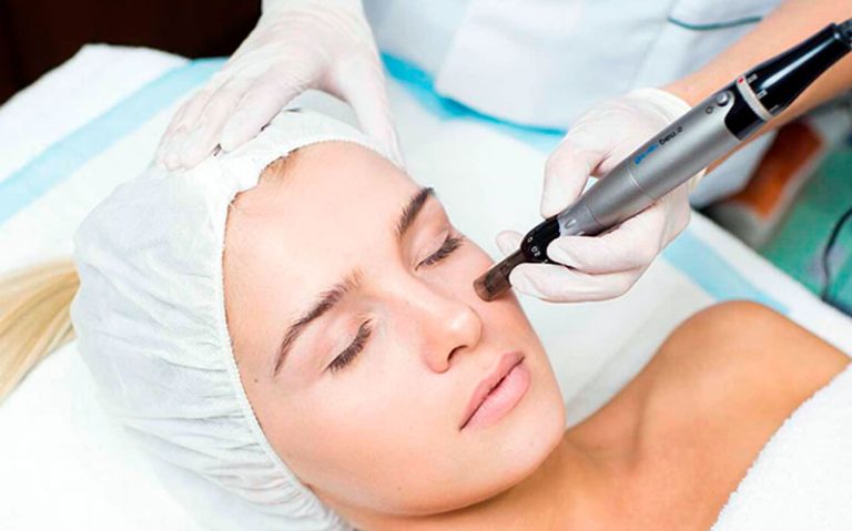 dermapen
