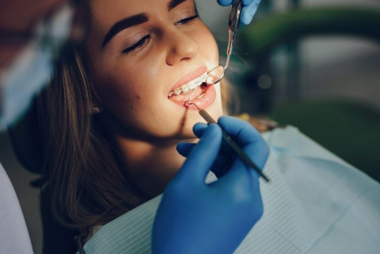 stripping dental